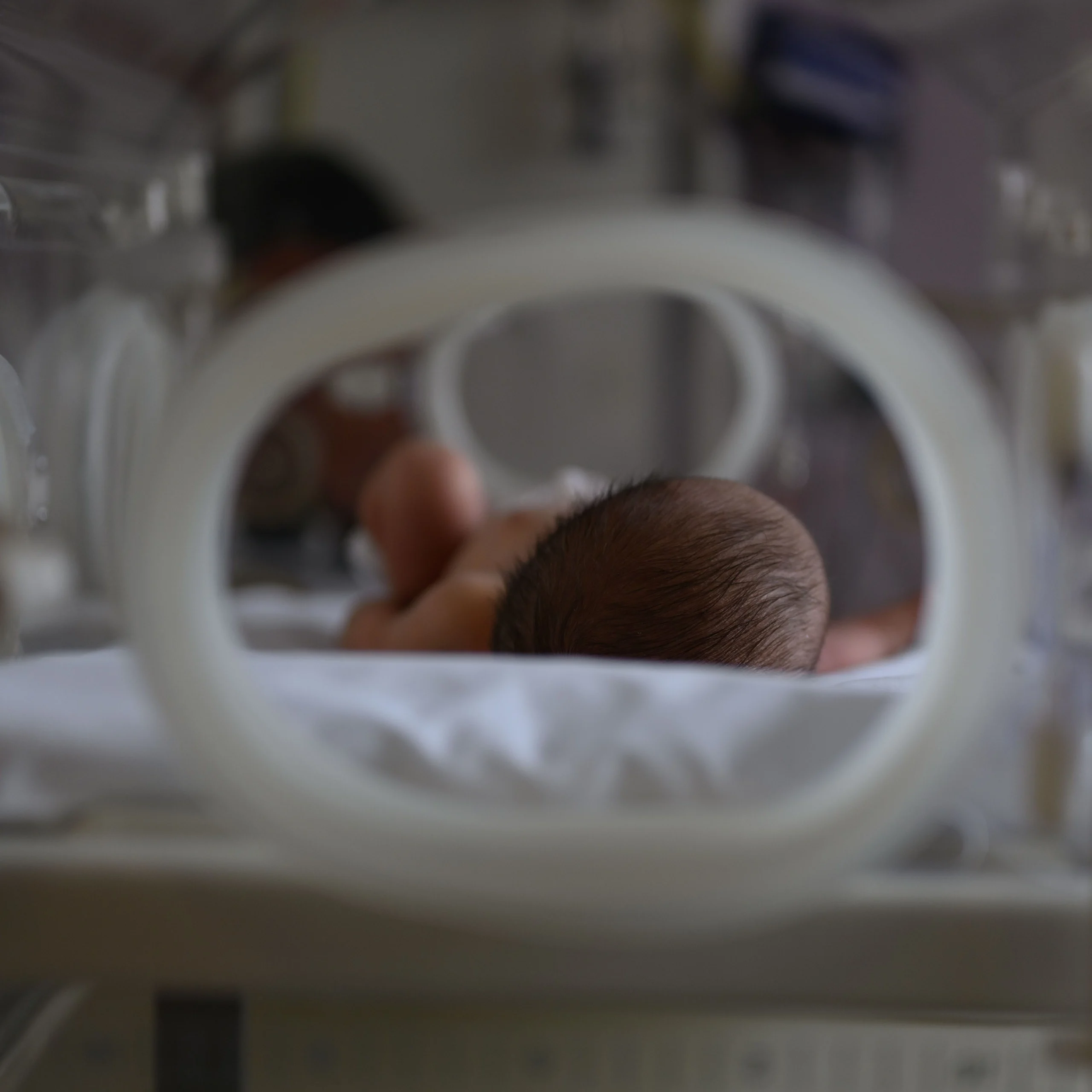 Hypoxic-Ischemic Encephalopathy