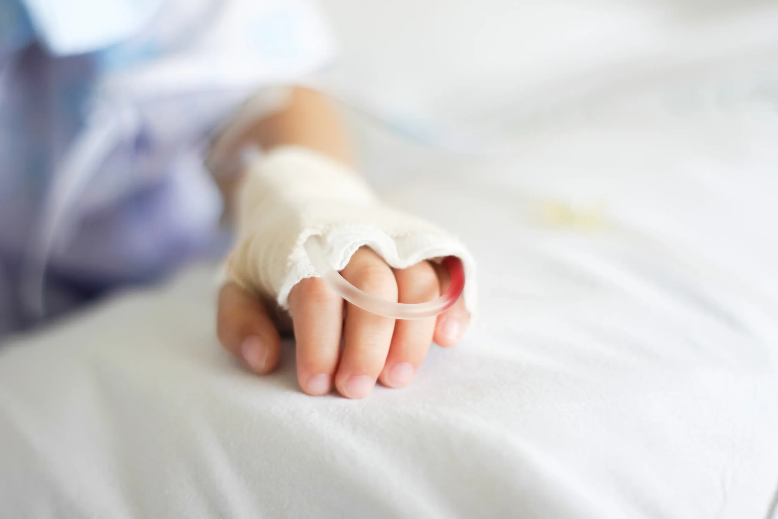 Child arm in hospital