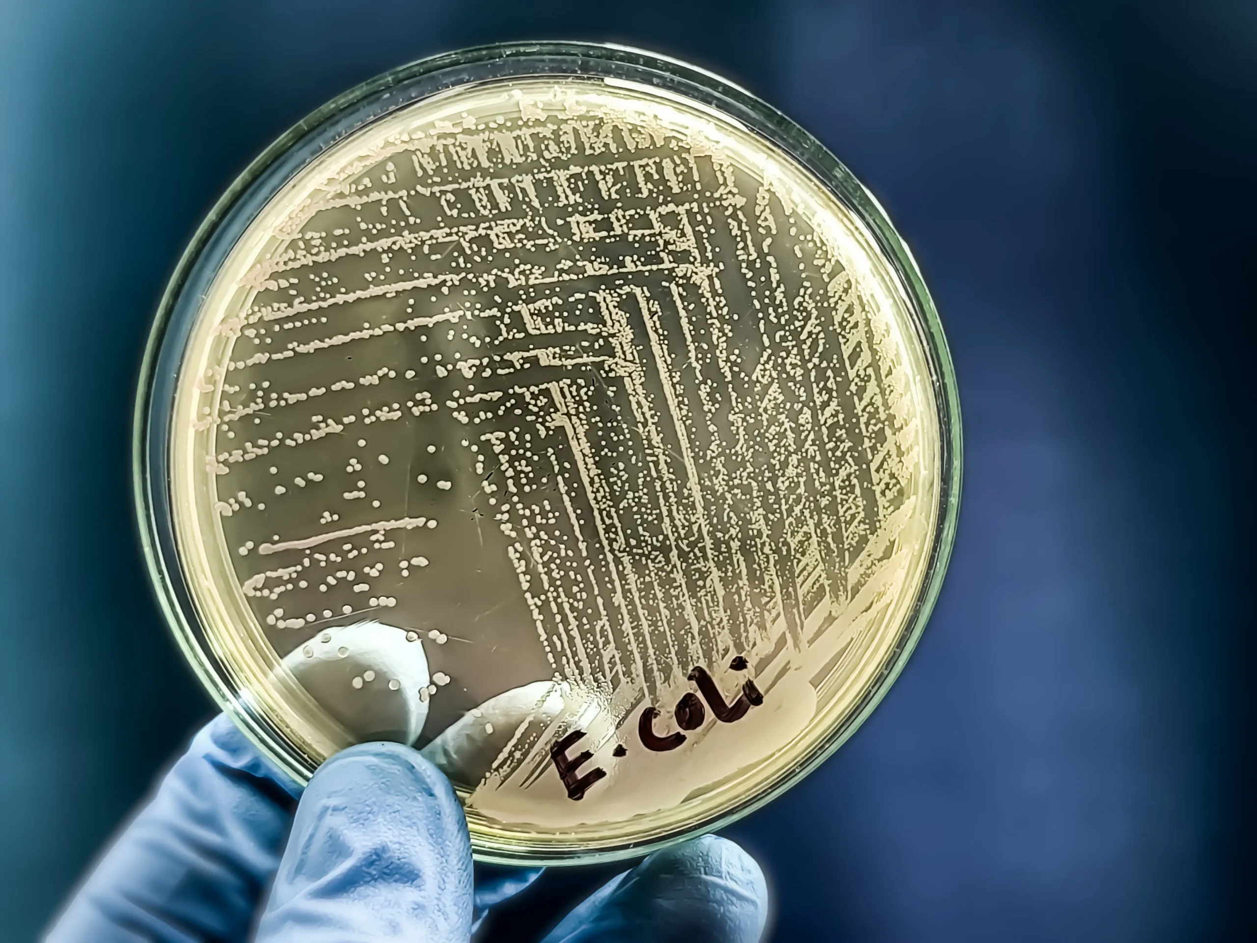 E Coli