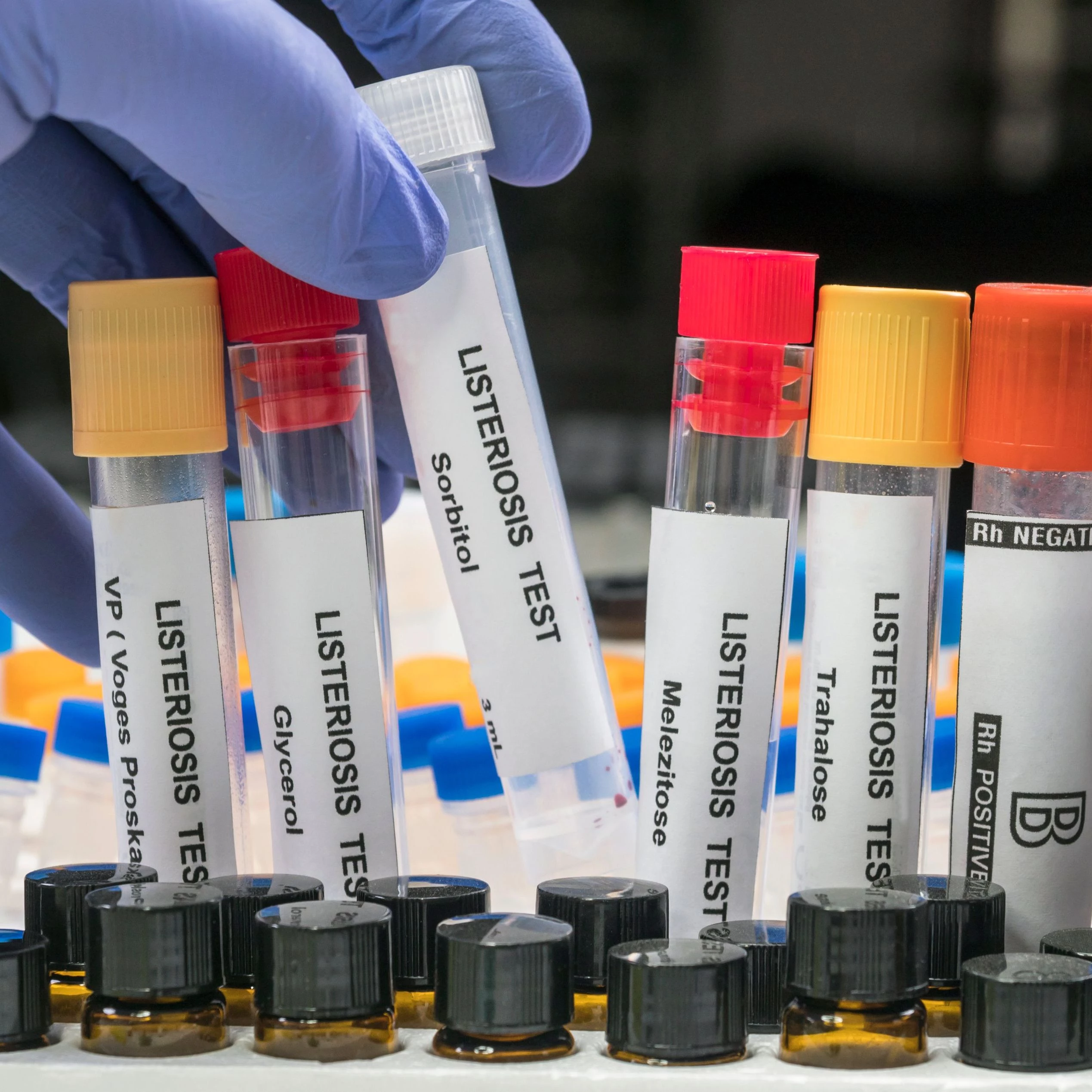Listeria testing