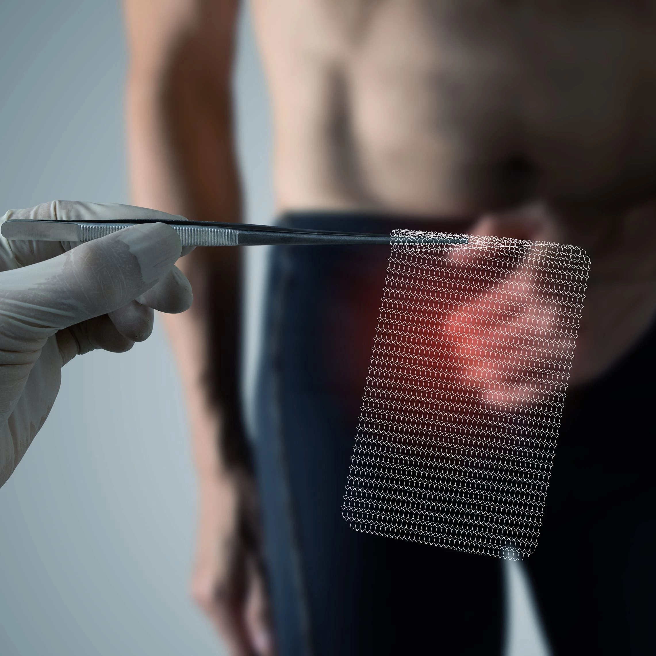 Hernia Repair