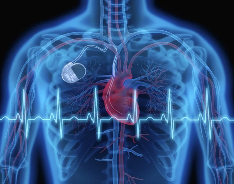 cardiac device failures